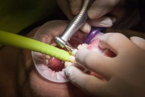 dentist work