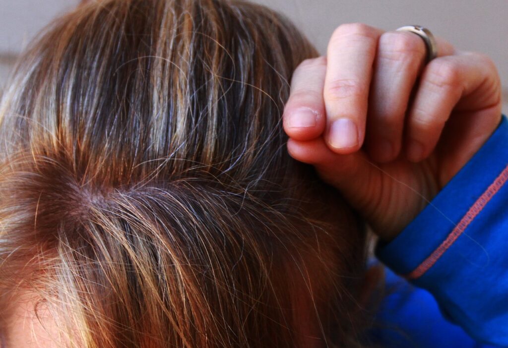 hair loss